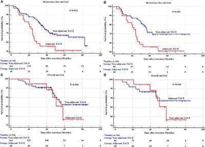 Adjuvant TACE may not improve recurrence-free or overall survival in HCC patients with low risk of recurrence after hepatectomy